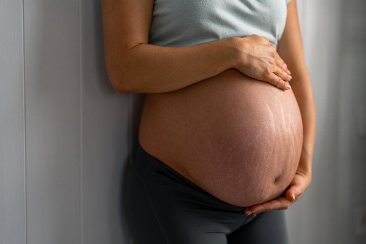 pregnancy stretch marks